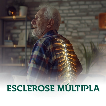 ESCLEROSE-MULTIPLA.webp